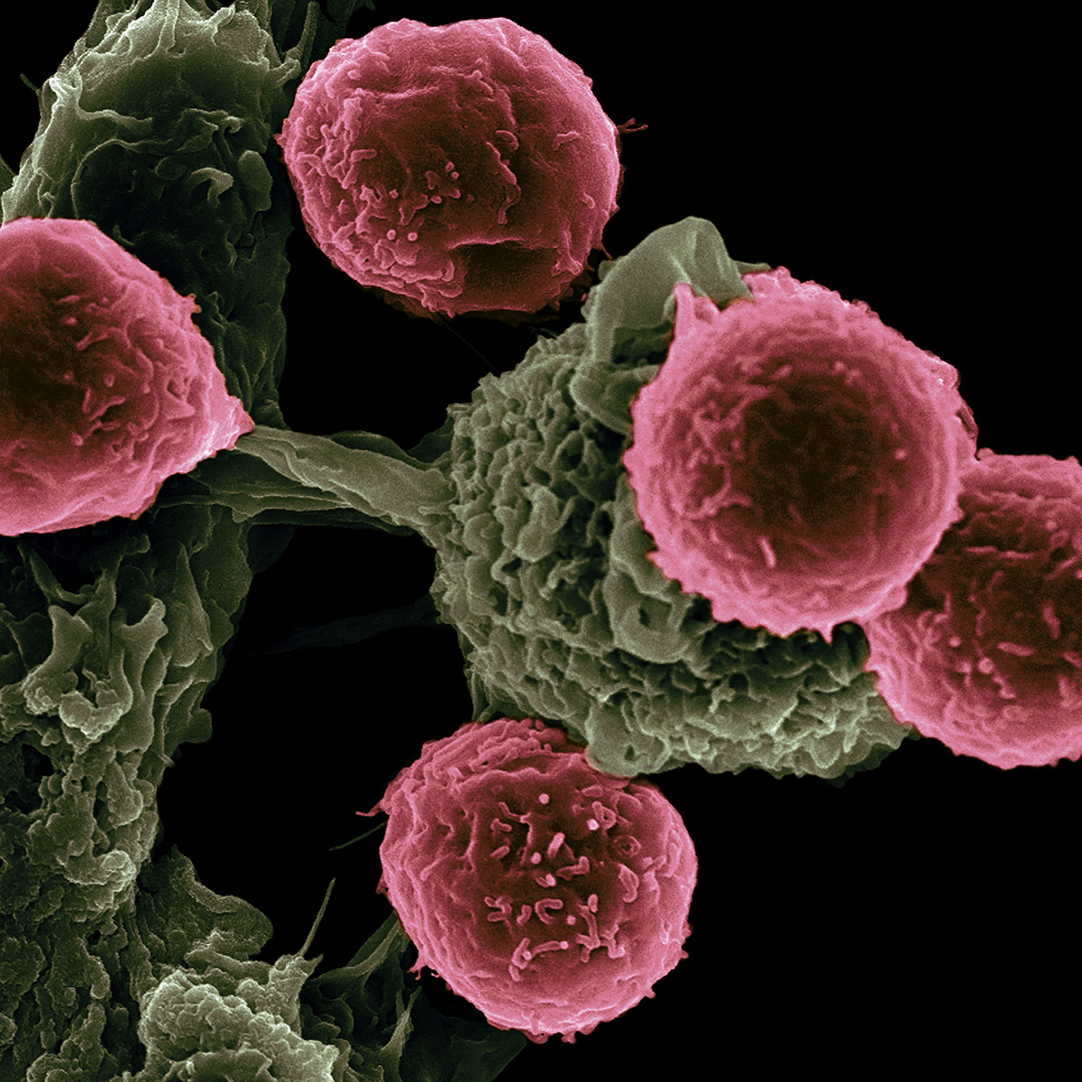 Новости онкологии: еще одно слабое звено раковых клеток