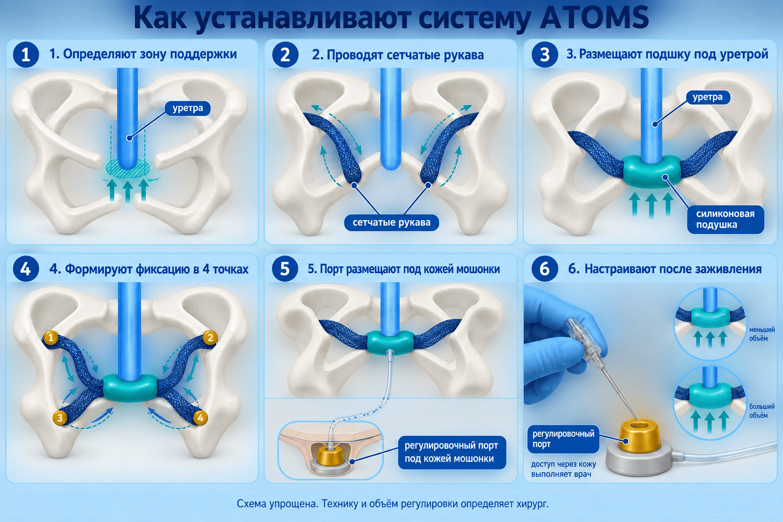 Как проходит операция ATOMS в Германии